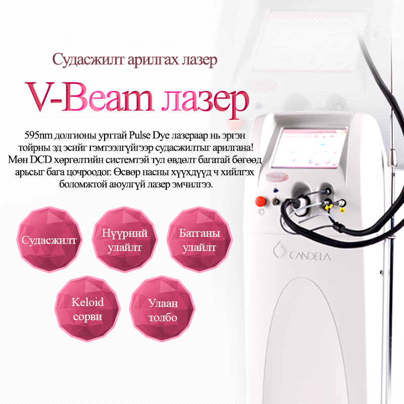 V-Beam лазер - VandS Hongdae