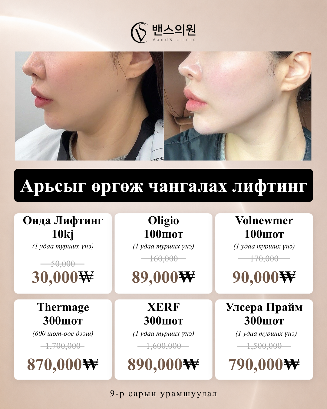 VandS Hongdae Арга хэмжээний зураг6